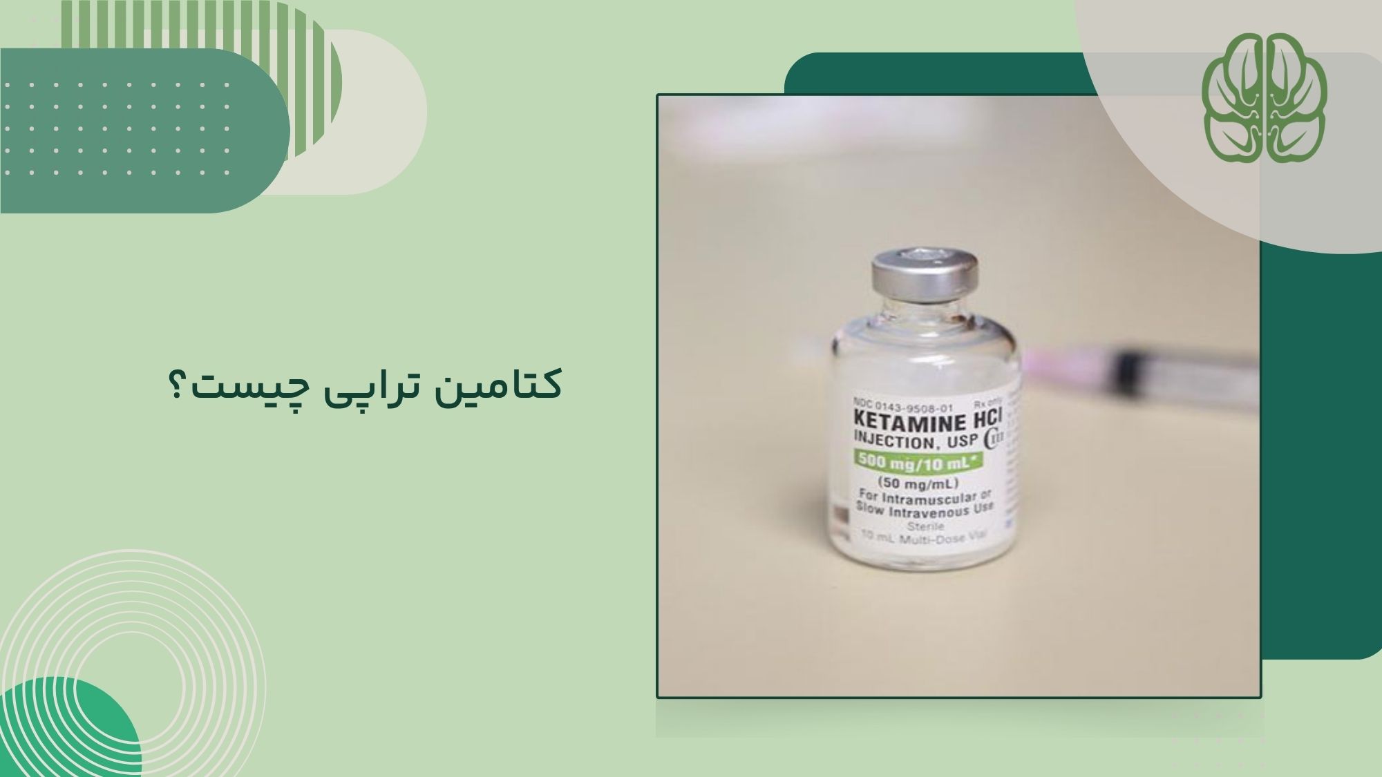 تجربه کتامین تراپی چگونه است