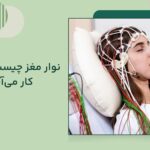 نوار مغز چیست