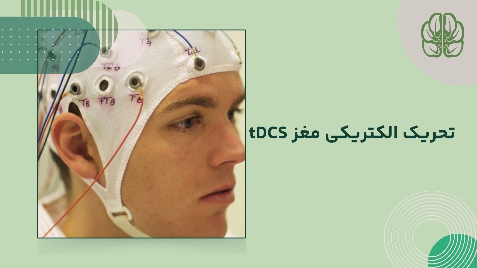درمان وسواس با دستگاه tDCS